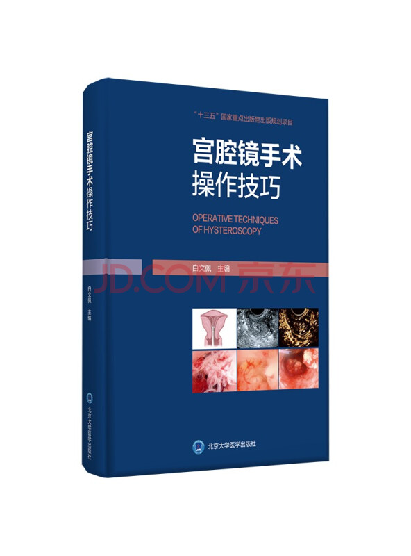 宫腔镜手术操作技巧