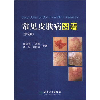 Ƥͼף3棩 [Color Atlas of Common Skin Diseases]