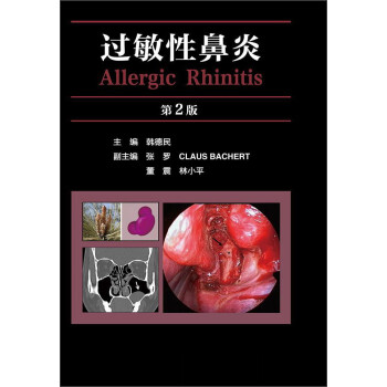 Աף2棩 [Allergic Rhinitis]