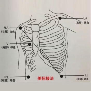 车载7寸转运多参数心电监护仪手术室便携家监测标配版配五导联心电