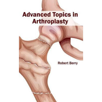 Advanced Topics in Arthroplasty