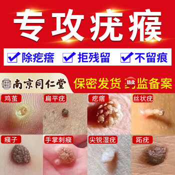 乐家老铺去i疣膏搭疣瘊净咪喹丨莫特乳膏去i疣灵尖锐湿疣除肉粒刺猴跖