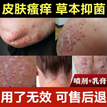 膏大腿內側肛門陰囊潮溼皮膚瘙癢止癢保溼 1套組合裝20g乳膏 35ml噴劑