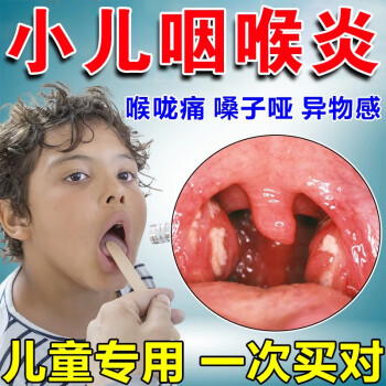 咽炎噴霧急慢性咽炎除根喉嚨有痰有異物兒童咽喉腫痛噴霧劑買送八盒裝