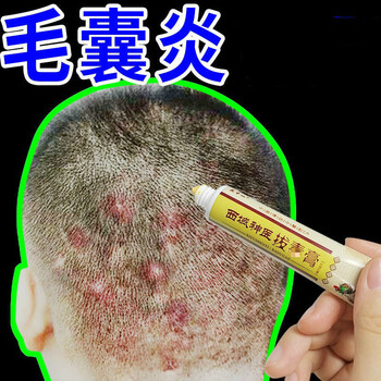 西域头皮毛囊l炎火疖子头部背部脓包疙瘩痤i疮痘痘红肿皮肤膏毛囊l炎