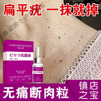 去i疣液扁平i疣脖子手足专用箹寻常i疣脖子肉粒颈部疙瘩扁平i疣去i疣