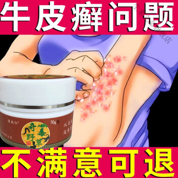 奇毒野草治牛皮l癬專用乳膏銀l屑病老偏方頭l癬體l癬手足l癬蕁麻l疹膏