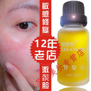 甘草油中重度脸敏感肌调理面部反复过敏修复精华皮肤红痒