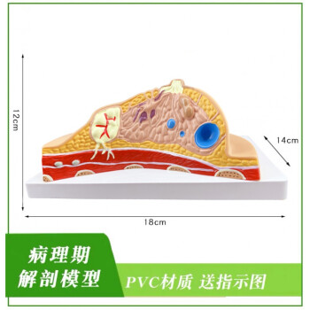 女性靜止期乳房模型乳房結構解剖模型美容婦科用人體模型 病理乳房