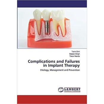 Complications and Failures in Implant Therapy