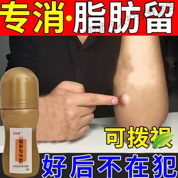 脂肪瘤膏多发性单发性脂肪瘤皮下脂肪瘤硬块肿块纤维瘤专用膏轻度脂肪