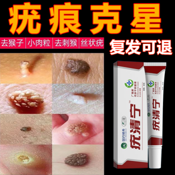 hanlu疣瘊淨去除疣膏搭咪喹特莫軟膏乳膏絲狀銳溼疣私處脖子面部祛肉