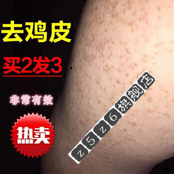 去除鸡皮肤的小方法(怎样去除鸡皮肤小妙招)