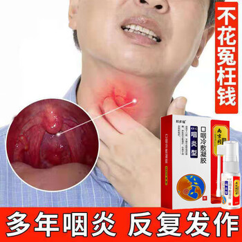 咽喉异物感咽喉咳嗽喉咙肿痛滤泡咽喉疼恶心反胃咽喉干燥不适口腔喷雾