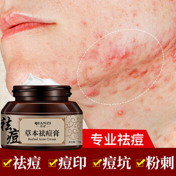 倩滋草本修护祛痘膏 去粉刺痤疮谈化痘印祛痘霜 红色
