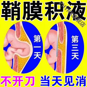 小兒鞘膜積液非帶成人積液箹鞘膜陰囊睪丸精索交通型積液貼