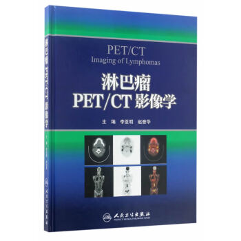淋巴瘤PET CT影像学 李亚明,赵晋华 人民卫生出版社 9787117242578