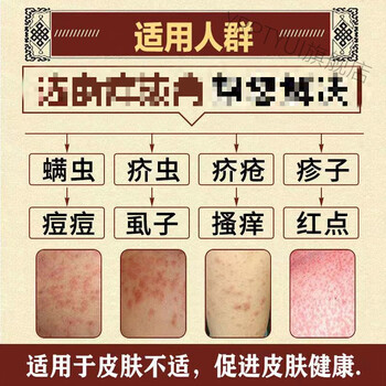 箹阴囊结节阴虱芥苍螨疥虫硫磺软膏