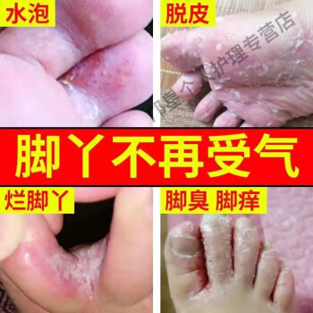 王爛1腳丫腳癢苗方本草一掃光噴劑軟膏腳臭1剋星止癢去一盒噴劑80ml