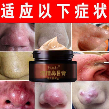 草莓鼻红鼻子酒糟鼻专用软膏去黑头粉刺螨痘痘红血丝修复男女 单盒装