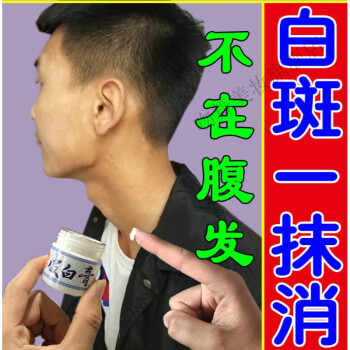 白色糠1疹膏兒童臉上有白斑長1癬單純糠1疹蟲斑一抹消斑20g