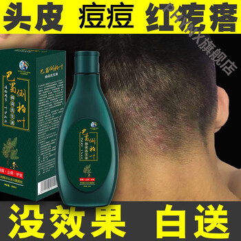 一晚洗好上长红疙瘩头皮长痘痘痒头皮屑多的洗发水治毛囊发l炎专用箹1