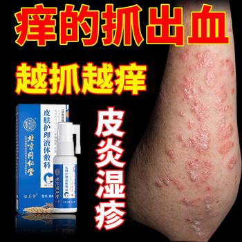北京同仁堂皮肤瘙痒止骚痒膏可搭喷剂去皮炎湿疹真菌感染过敏身体痒专