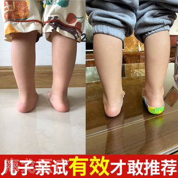 扁平足矫正鞋垫医用儿童定制高足弓支撑垫平脚板足外内翻纠矫正器 18