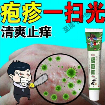 云南百草霜皮肤瘙痒止痒汗h疱p疹手脚小水泡专用牛l皮x癣湿s疹苗箹 5