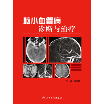脑小血管病诊断与治疗pdf/doc/txt格式电子书下载