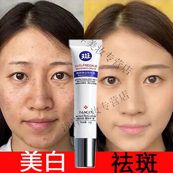 氢醌霜美肤白祛l斑霜去斑老年斑脸上黑色素美肤白去l黄顽固一支