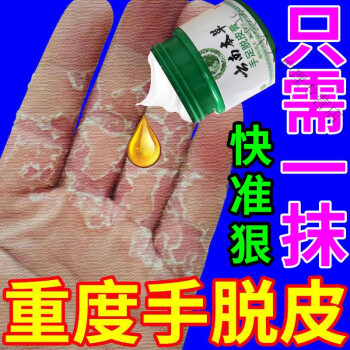 手脱皮用红霉素软膏图片