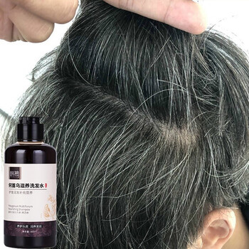 何首乌治白发转乌发变黑发去屑止痒中药草本男女白发治发根少白头白转