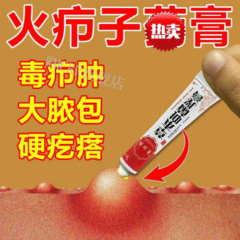 顽达康火疖子拔脓红肿疙瘩大脓包痘痘坐扳疮屁股去脓包脸上硬疙瘩1盒
