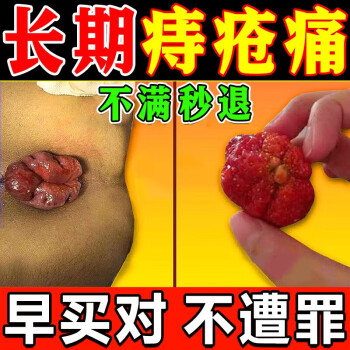 仁爱和痔疮膏去肉球内外混合痔疮卡波姆痔疮凝胶肛门瘙痒非马应龙