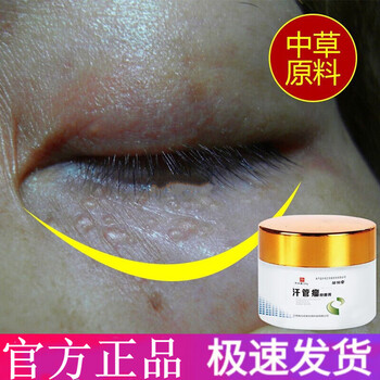 邹润安汗管瘤膏专用膏油脂粒眼周眼下小颗粒专用膏 买三贈二收五 一盒
