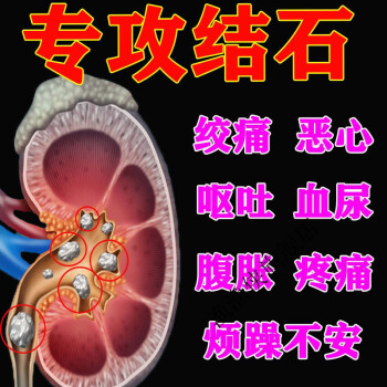 【3天消石】膽囊結石腎結石貼腎臟結石膽康貼腹痛惡心特孝排石貼輸尿