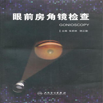 眼前房角镜检查