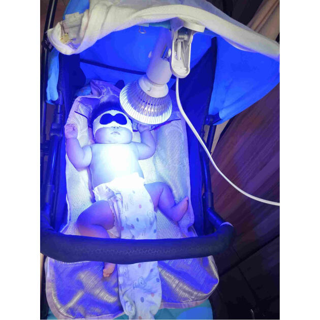 测黄疸仪器家用新生儿去黄退黄婴儿降黄照蓝光led专用灯测试仪检测仪