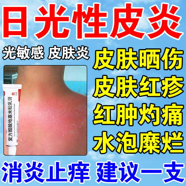 日光性皮炎专用药晒伤修复药膏紫外线过敏皮肤灼伤瘙痒红肿起泡干燥