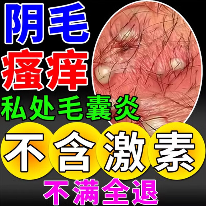 外阴私处毛囊炎艾草沐浴露男女性专用下体阴部止瘙痒真菌感染长痘痘硬