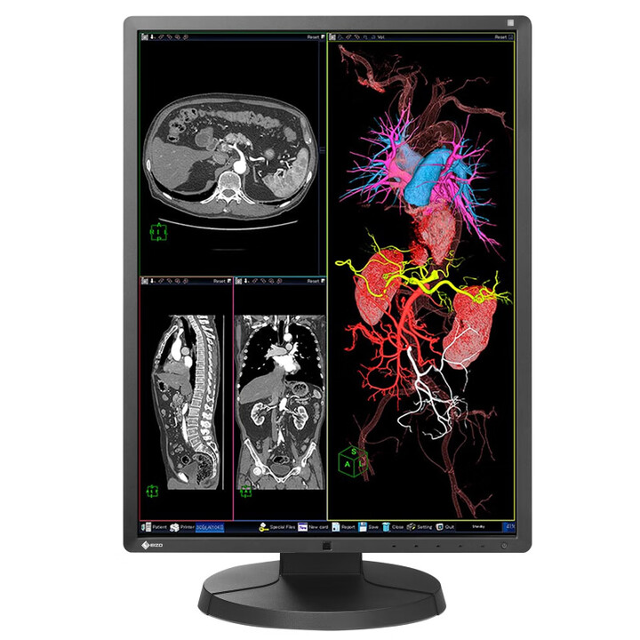 艺卓二手21寸EIZO RX350摄影设计X射线CR\DR灰阶图像医用医疗3M显示器 21寸RX350库存效果 1536X2048【图片 价格 ...