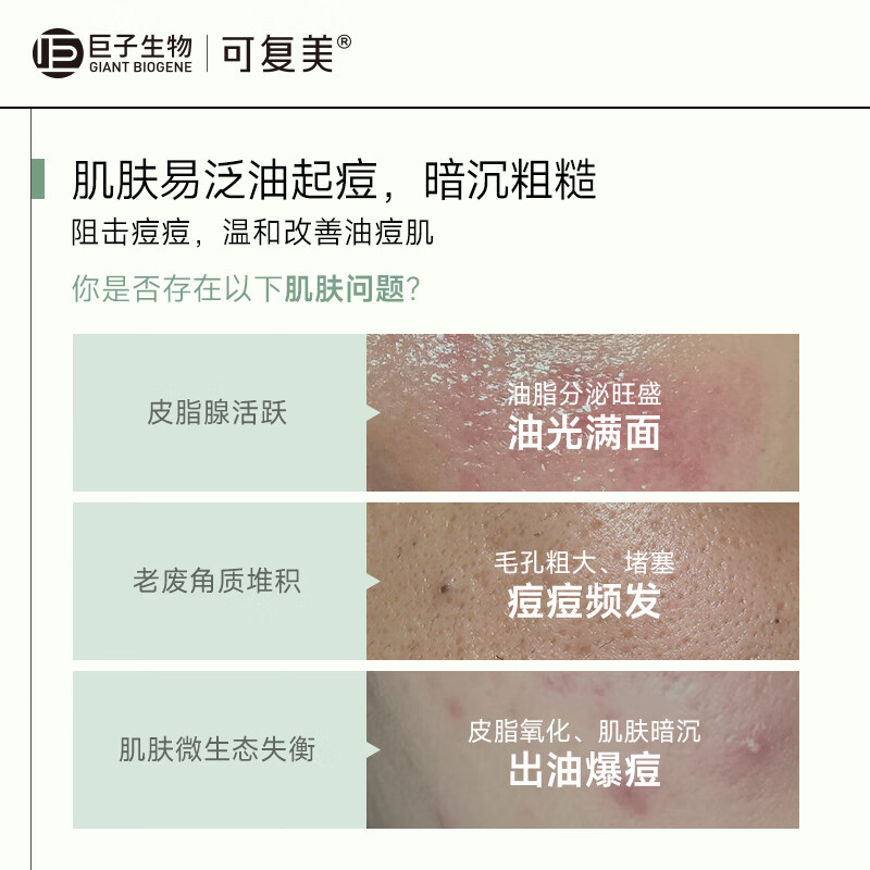 可复美稀有人参皂苷致研净痘控油精华水150ml/瓶 秩序水祛痘控油去角质