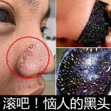 "祛黑头螨虫撕拉面膜"