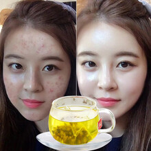 益甘茶菊决明子茶熬夜搭配养肝护肝枸杞菊花决明子青肝茶排毒去肝火明目降转氨酶脂肪肝茶大小三阳养生保涵鹭 三盒装(二盒价)