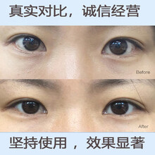 德德维芙眼膜贴淡化细纹紧致皮肤去黑眼圈眼袋法令纹鱼子酱黑眼膜眼贴抗皱补水保湿熬夜男女60片/盒 第二盒5折 实发*2盒【优惠装】