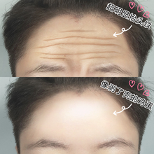 萃季抬头纹贴男女士额纹贴睡眠额头皱纹贴川字纹表情纹提拉紧致淡化贴 买三送二【淡额纹新宠】*50片