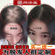 超市	
【贵州同济堂】防脱洗发水生姜育发头发增长液溢脂性脱发去油草本长发老姜王姜汁护发密发洗头水 一瓶300ml【3瓶周期使用效果更好】