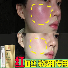 南京同仁堂去红血丝修复去除护肤品角质层薄加厚去高原红补水保湿舒缓精华液敏感肌肤修复百幽草 一瓶装100ml