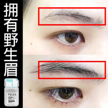 眉毛滋养液眉毛增长液男士生眉液浓密乌黑卷翘眉毛女睫毛增长液眉毛生长液睫毛生长液 3瓶周期装【巩固长度，长效呵护】